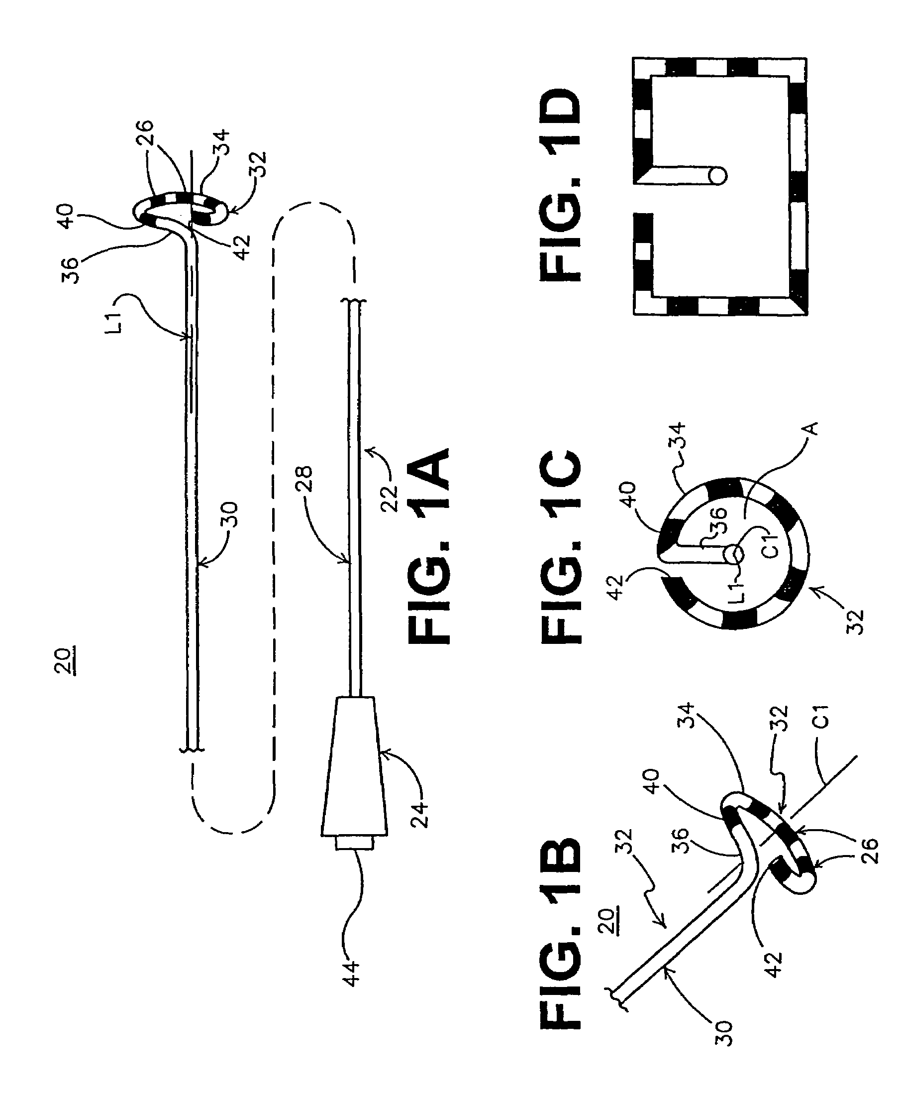 Ablation catheter assembly and method for isolating a pulmonary vein