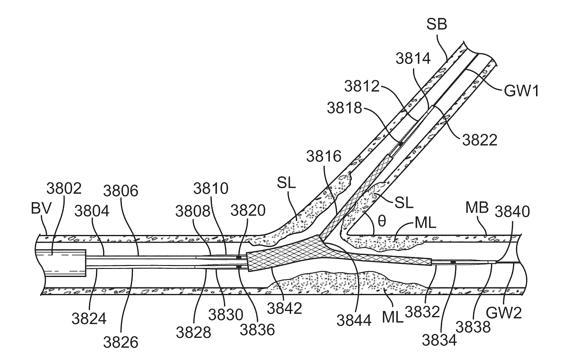 System and methods for treating a bifurcation