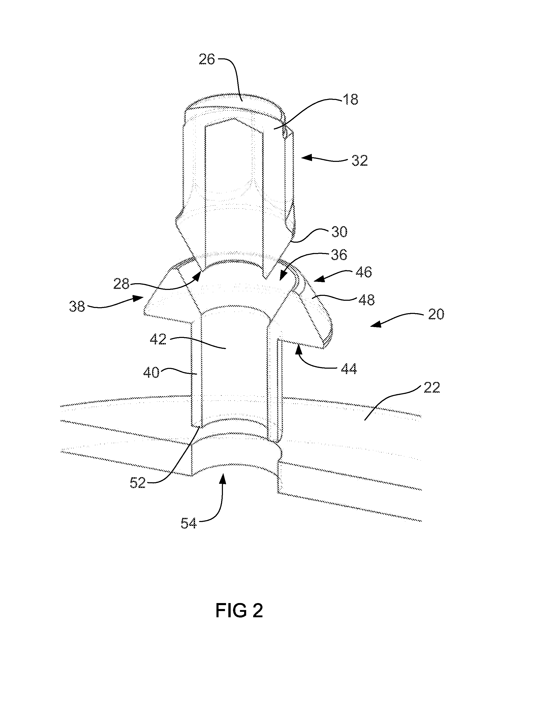 Attachment arrangement for composite wheels