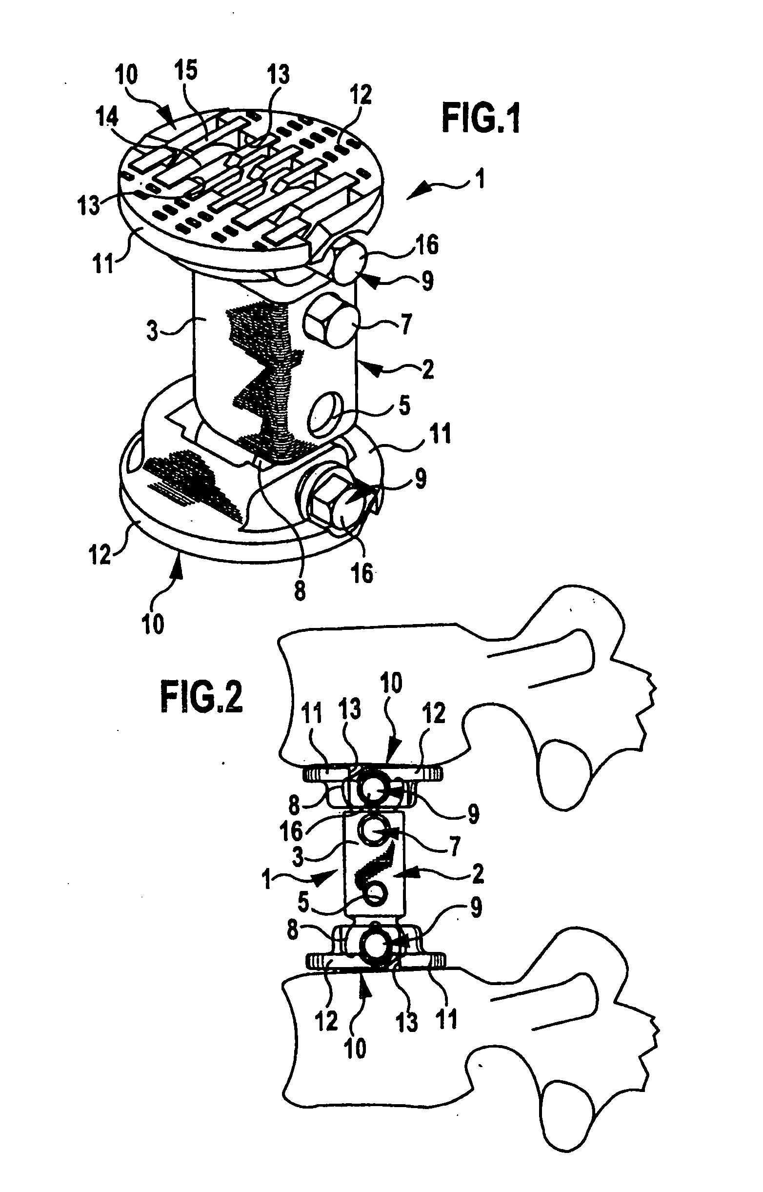 Spinal column implant