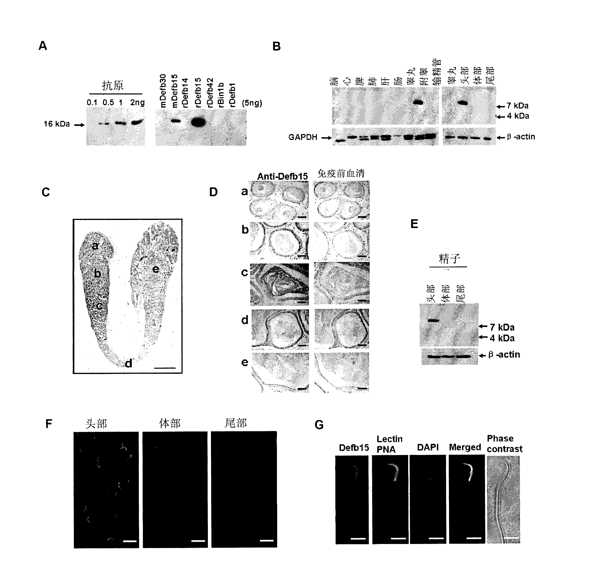 Beta-defensin 15 of specific antibacterial peptides of rat epididymis and application thereof