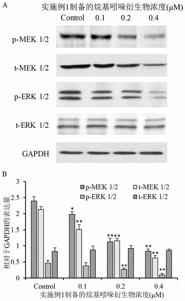 Application of a kind of alkylindolinone derivative and antithyroid tumor drug