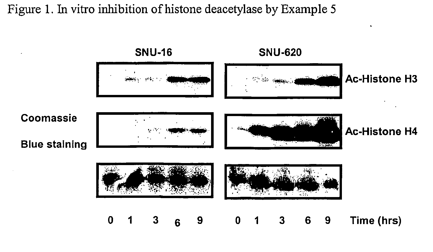 Alpha, beta-unsaturated hydroxamic acid derivatives and their use as histone deacetylase inhibitors