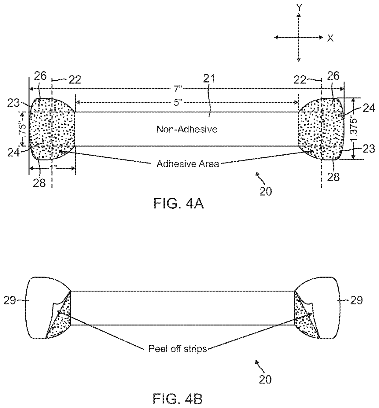 Noninvasive device and method for neck lift