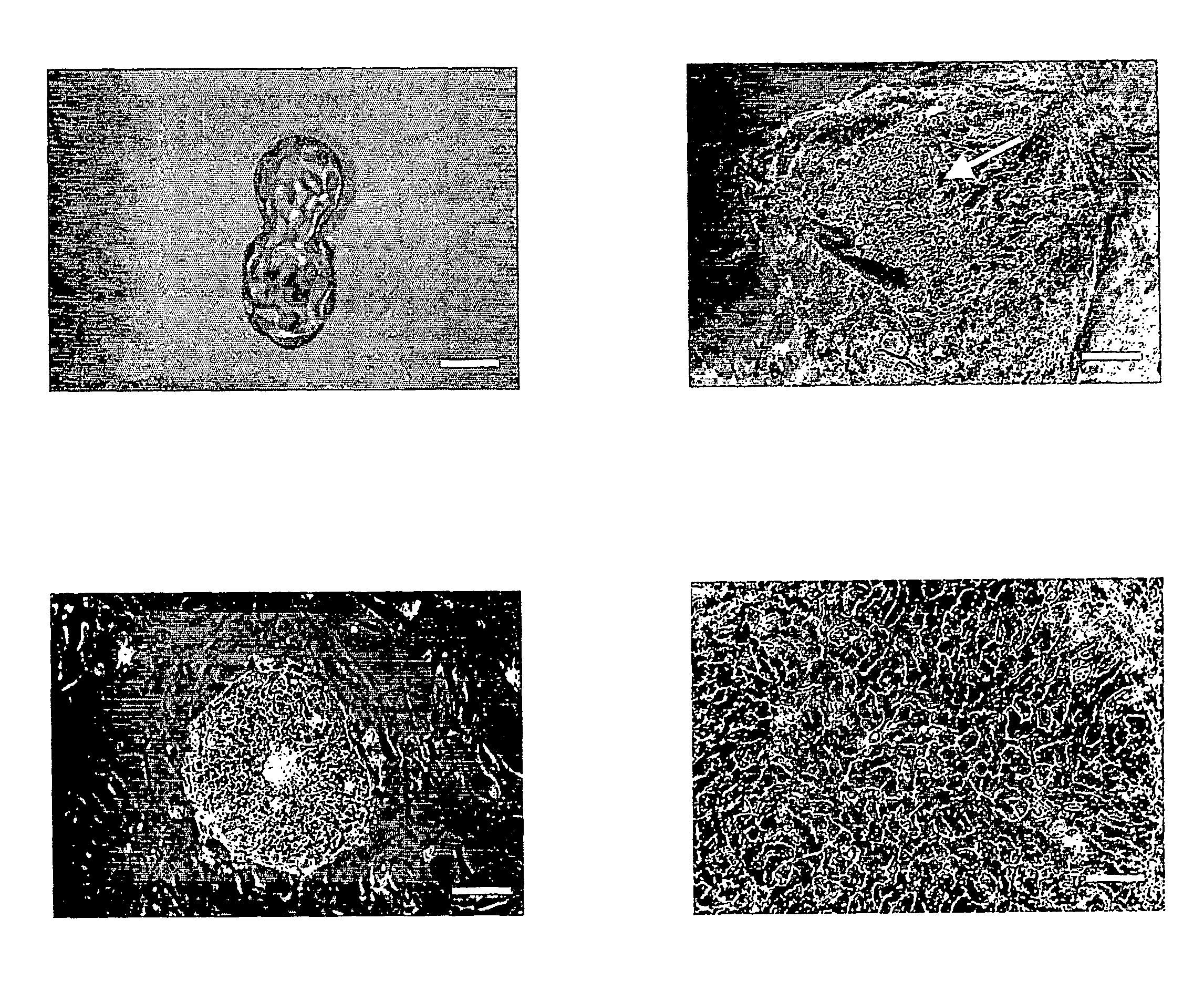 Methods of Generating Stem Cells and Embryonic Bodies Carrying Disease-Causing Mutations and Methods of Using same for Studying Genetic Disorders