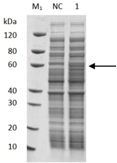 Talaromyces marneffei mannan protein and application of talaromyces marneffei mannan protein in preparation of talaromyces marneffei antibody detection kit