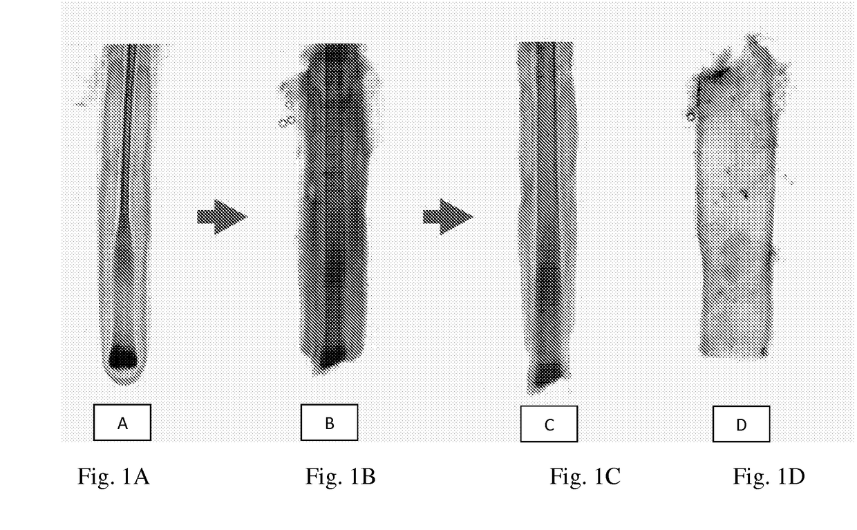 Compositions and methods for treating bone, joints and cartilage