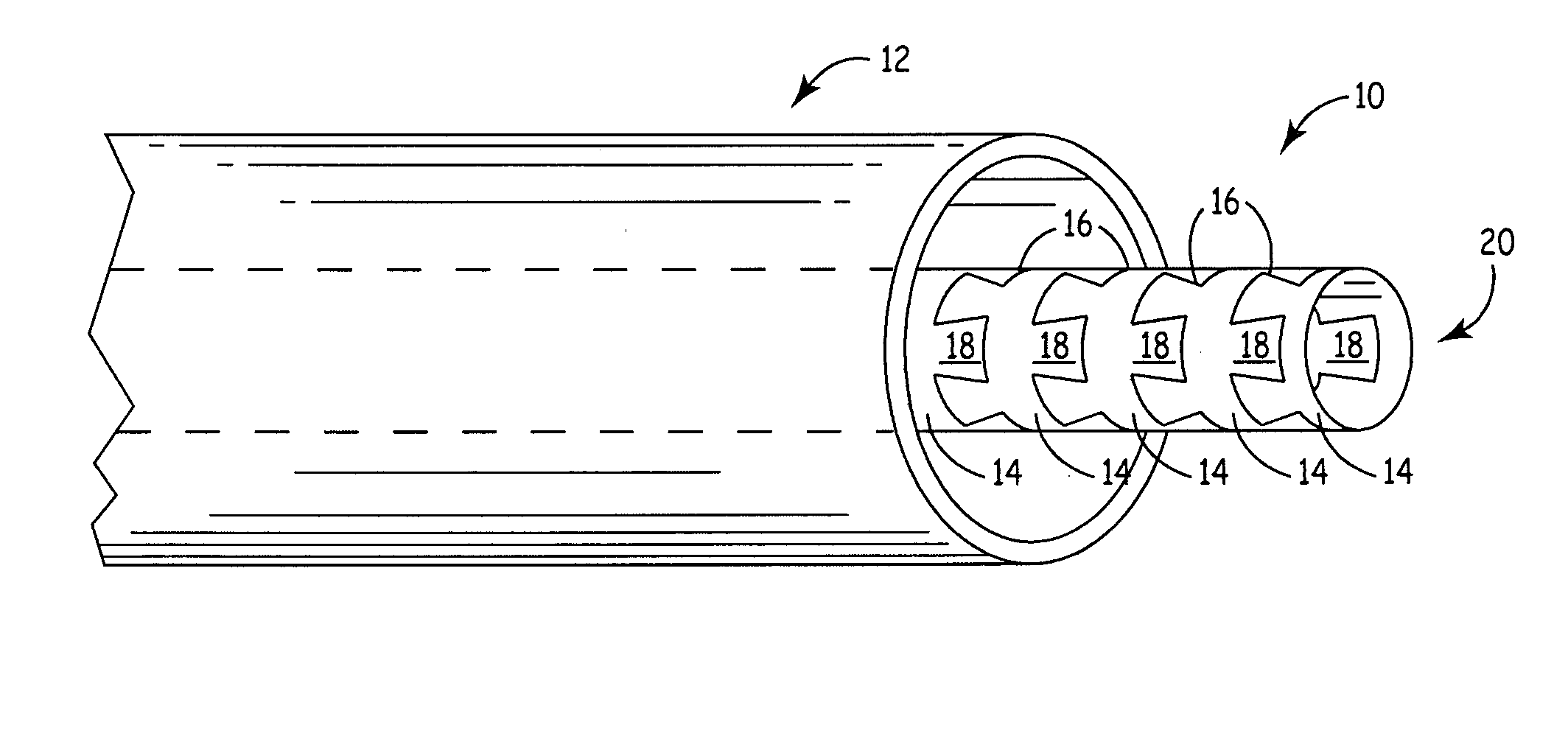 Flexible medical device