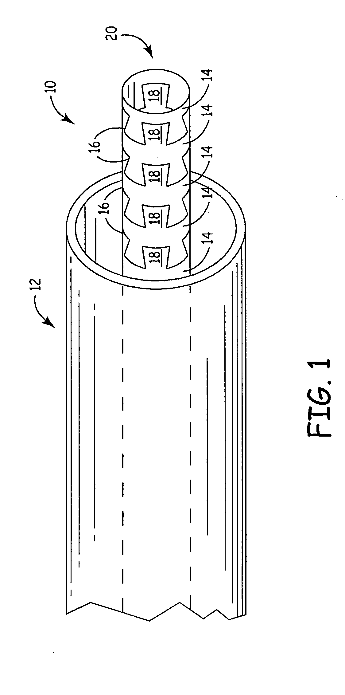 Flexible medical device