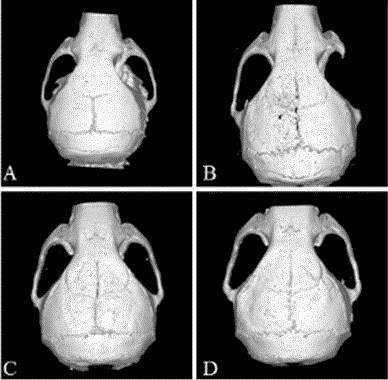 Pharmaceutical use of levodopa methyl ester hydrochloride in the treatment of periprosthetic osteolysis