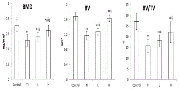 Pharmaceutical use of levodopa methyl ester hydrochloride in the treatment of periprosthetic osteolysis