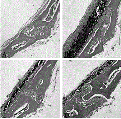 Pharmaceutical use of levodopa methyl ester hydrochloride in the treatment of periprosthetic osteolysis