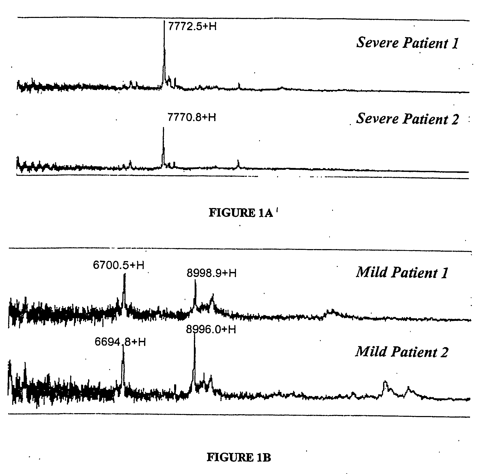 Serum biomarkers in ischaemic heart disease