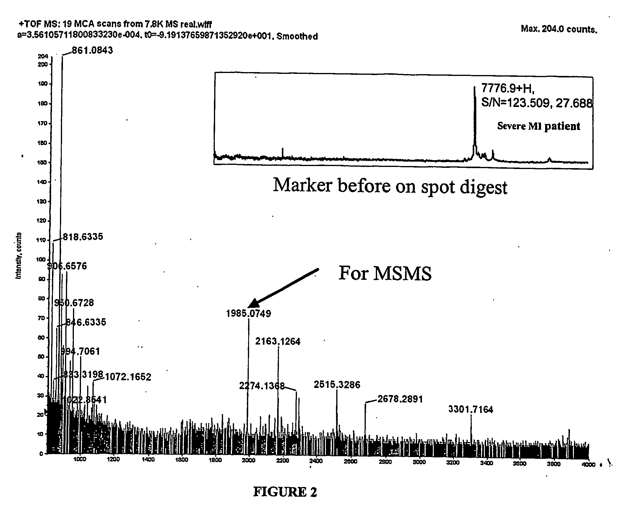 Serum biomarkers in ischaemic heart disease