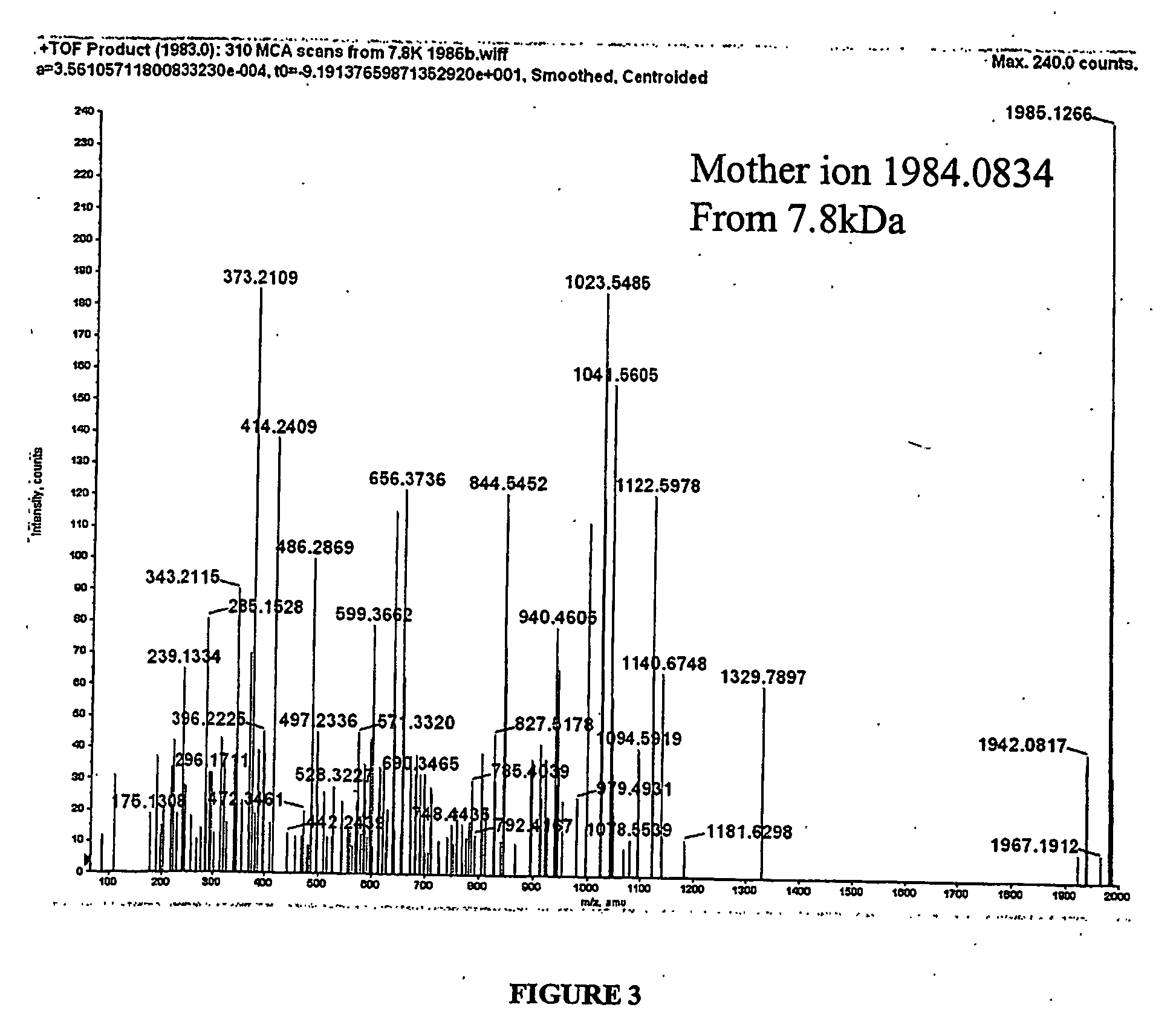 Serum biomarkers in ischaemic heart disease