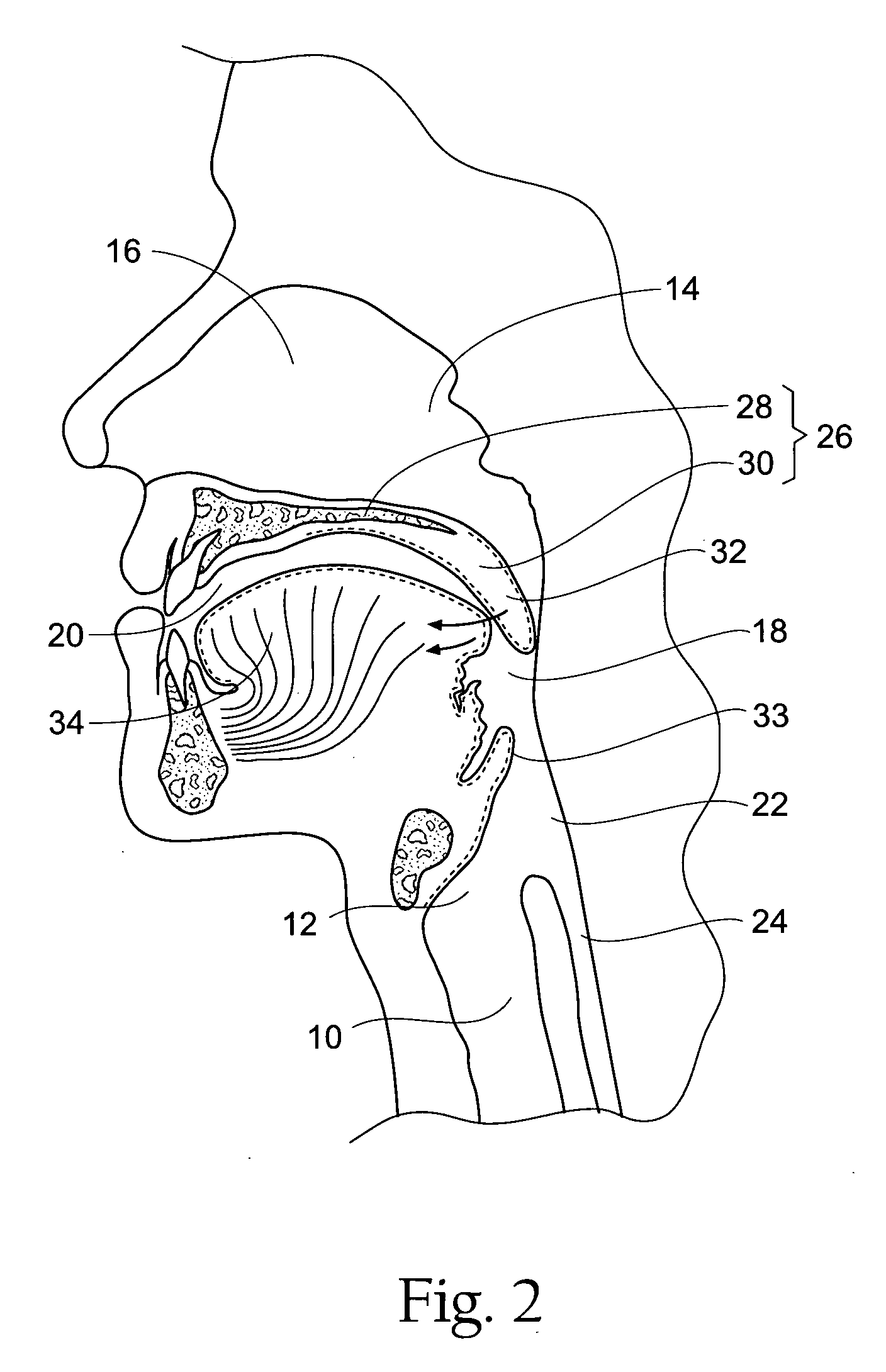 Systems and methods for moving and/or restraining tissue in the upper respiratory system