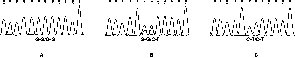 A molecular marker associated with the "tailless" phenotype of Chinese fat-rump sheep and its application