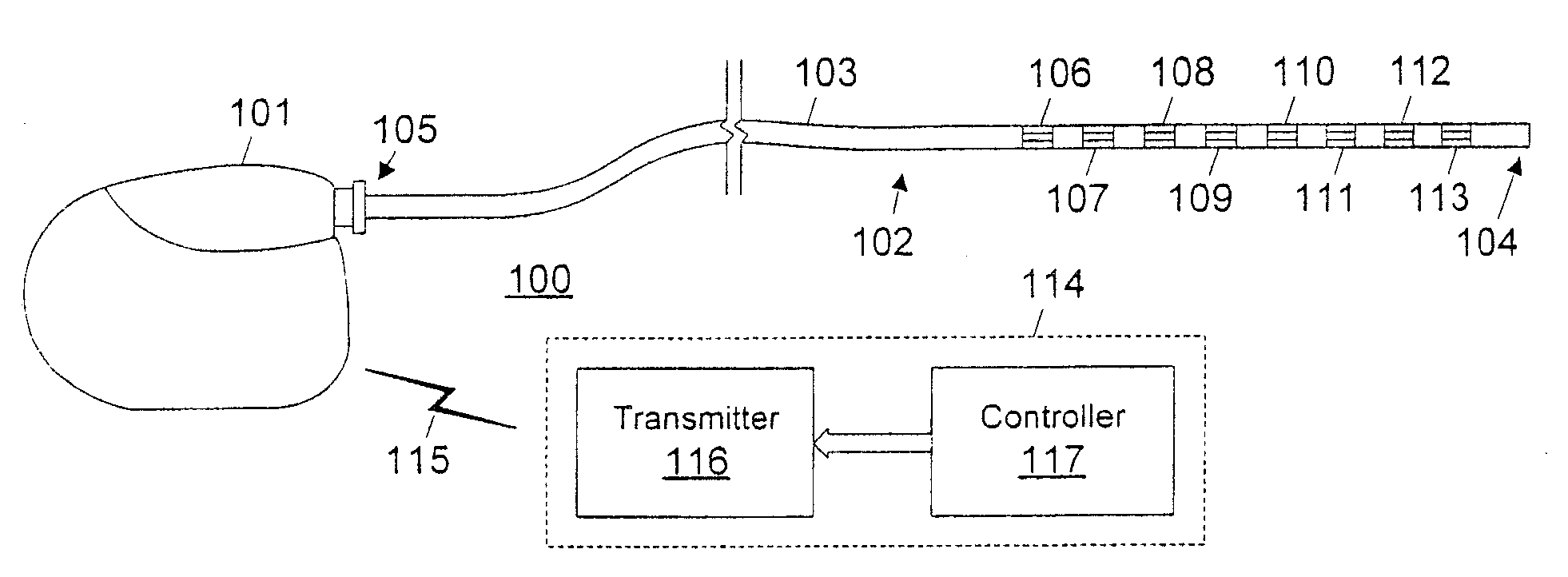 Active discharge systems and methods