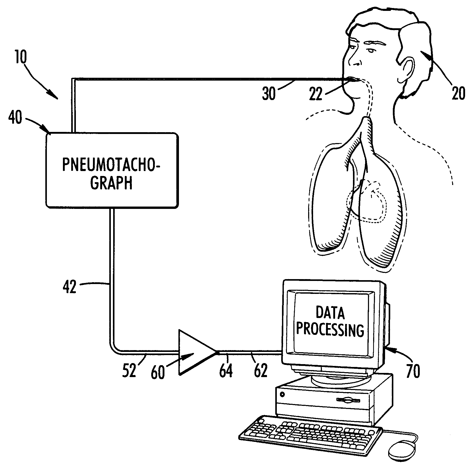 Method and system for continuously monitoring cardiac output