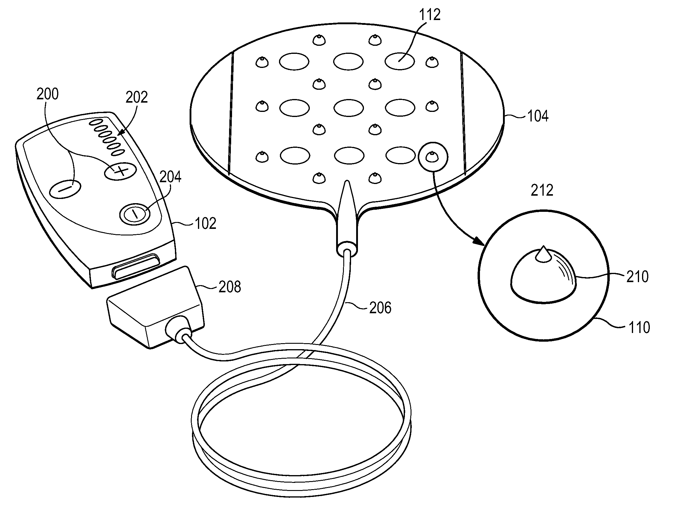 System and method for stimulating sensory nerves