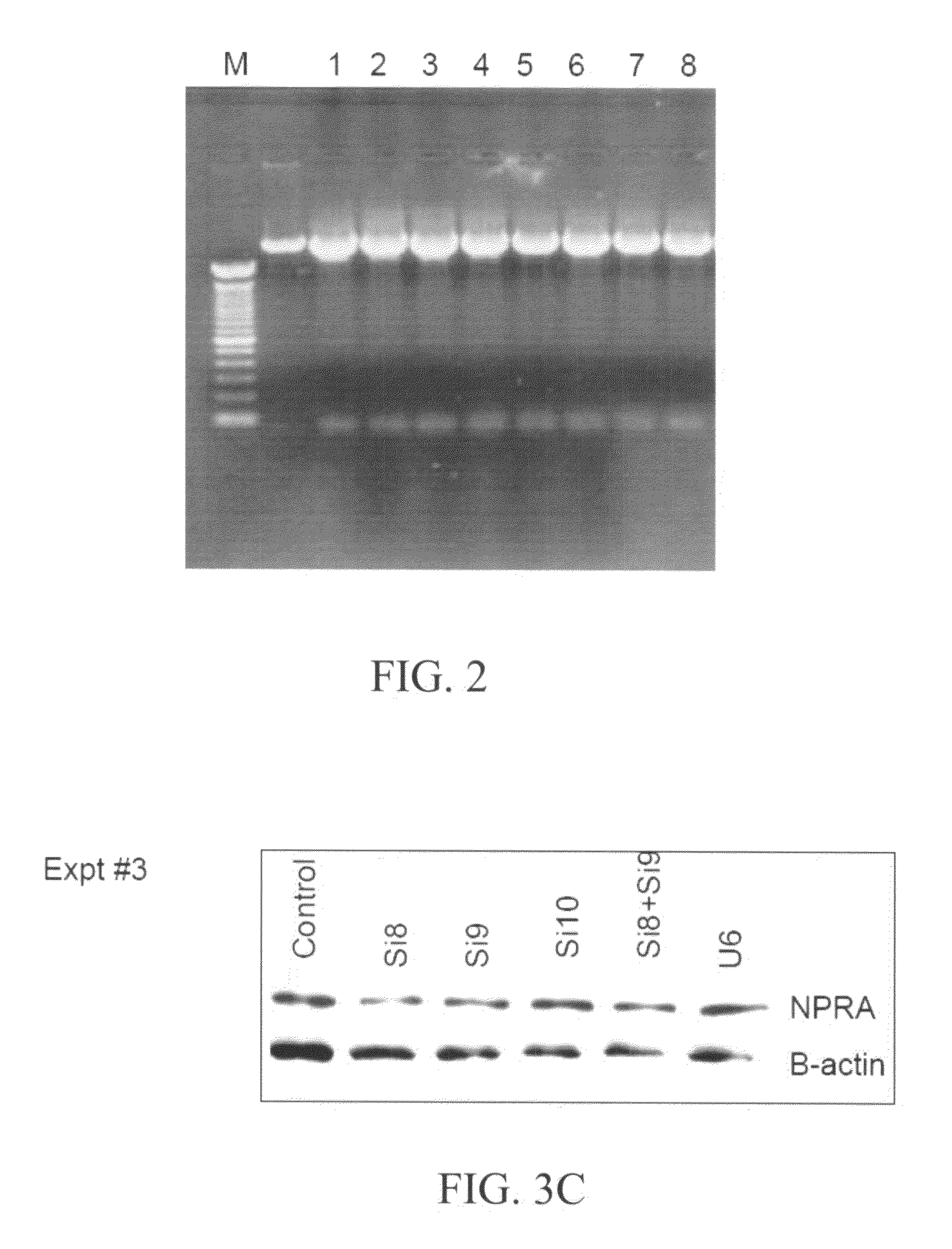 Materials and methods for reducing inflammation by inhibition of the atrial natriuretic peptide receptor