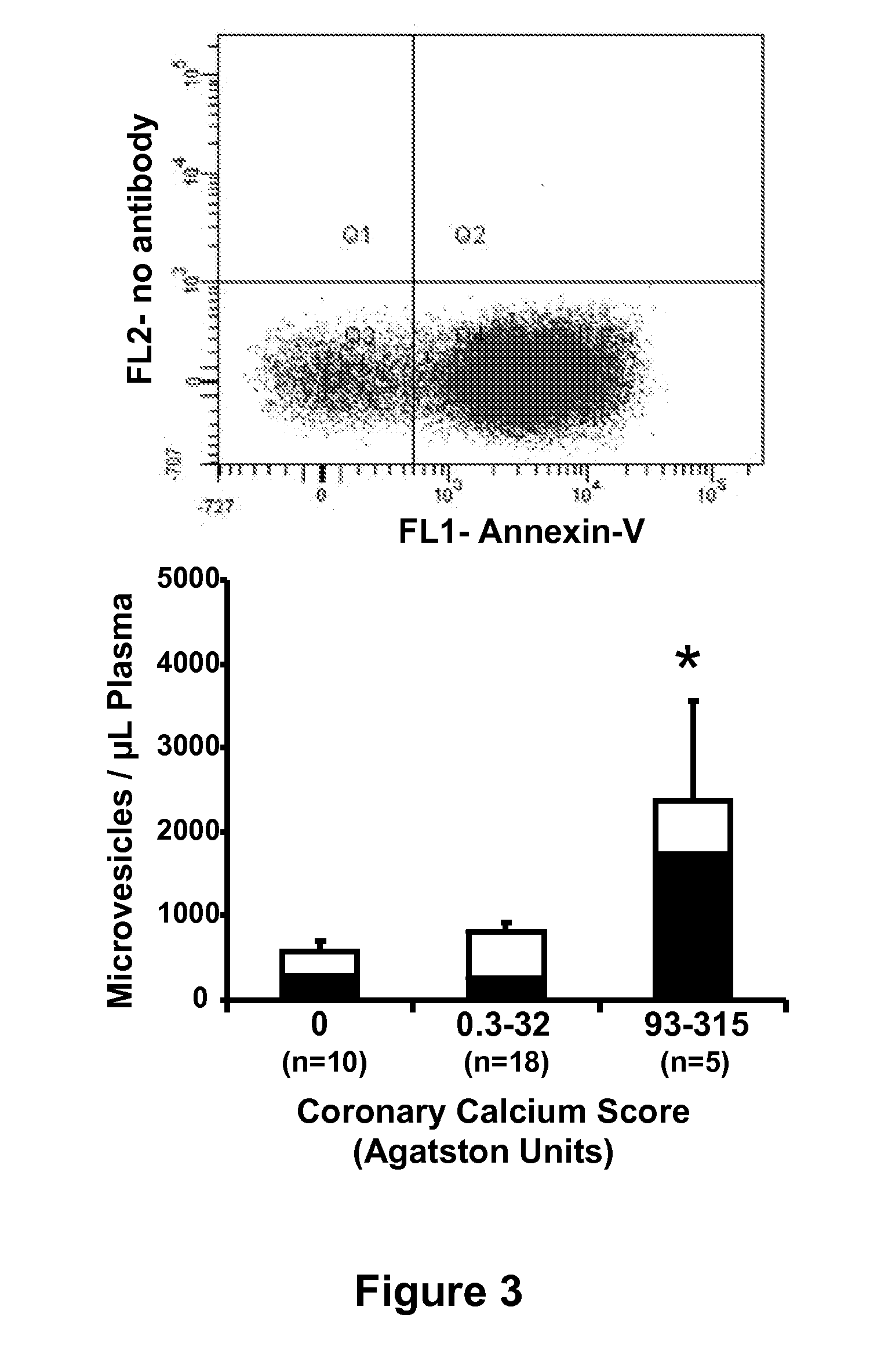 Identifying coronary or soft tissue calcification