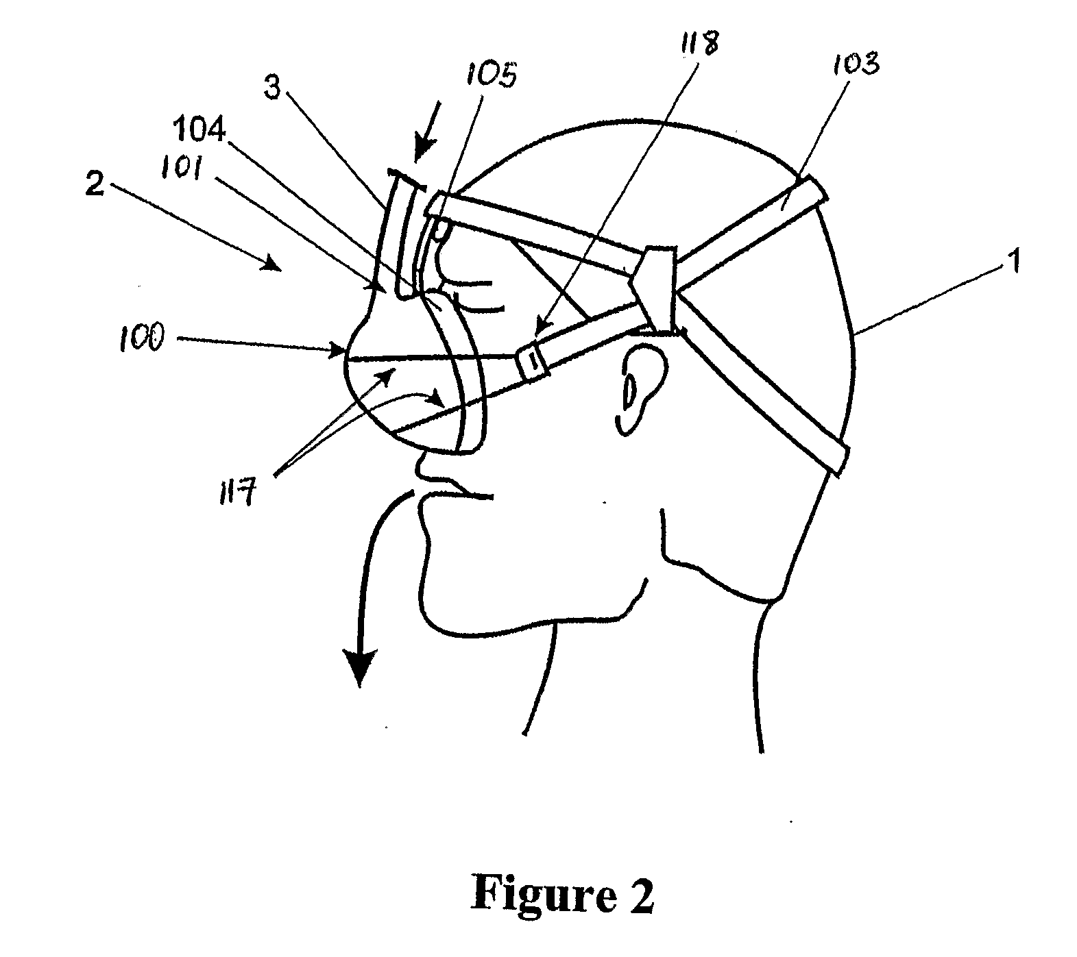 Breathing Assistance Apparatus