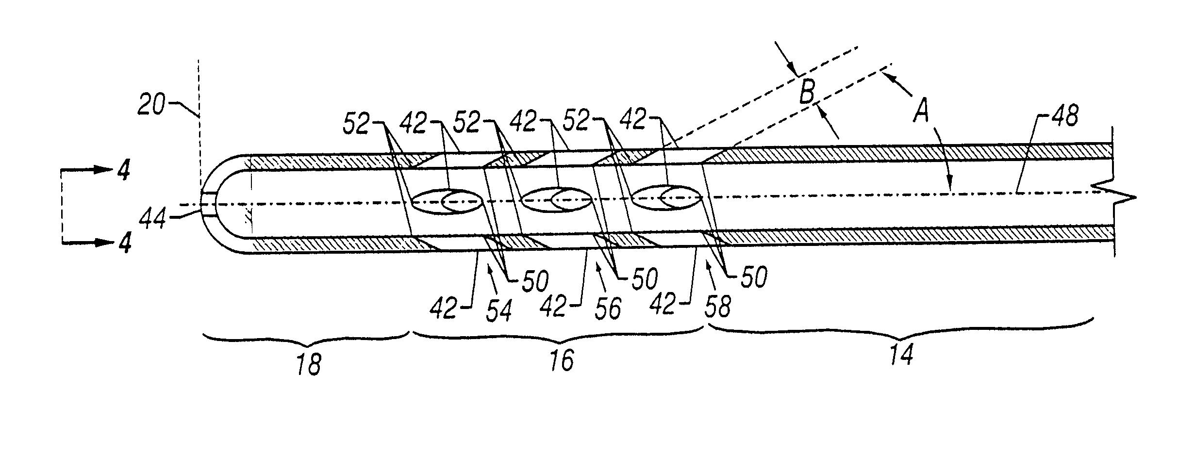 Anti-recoil catheter