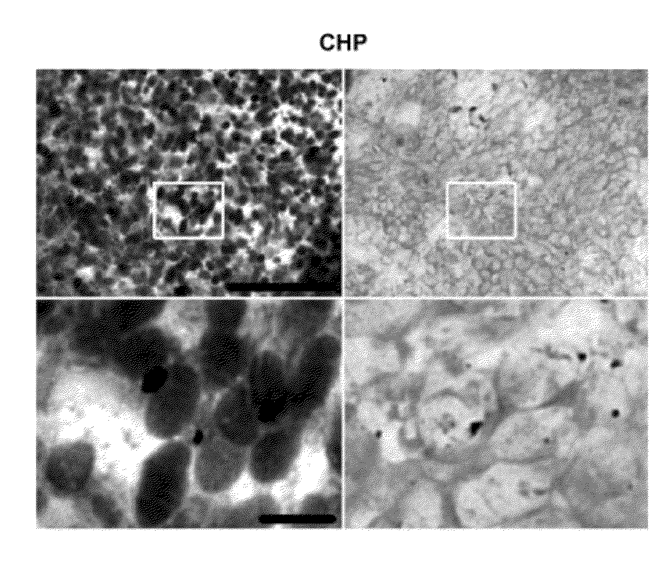 Carcinoma Homing Peptide (CHP), Its Analogs, and Methods of Using