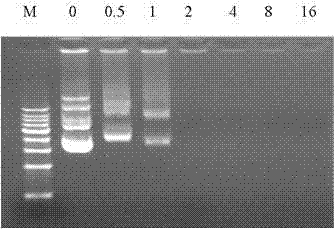 Compound of prostate stem cell antigen polypeptide and nucleic acid and preparation method and application thereof