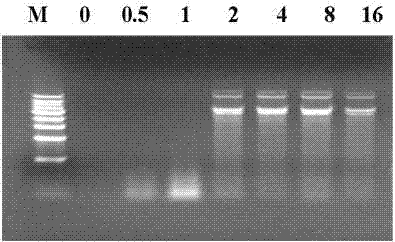 Compound of prostate stem cell antigen polypeptide and nucleic acid and preparation method and application thereof