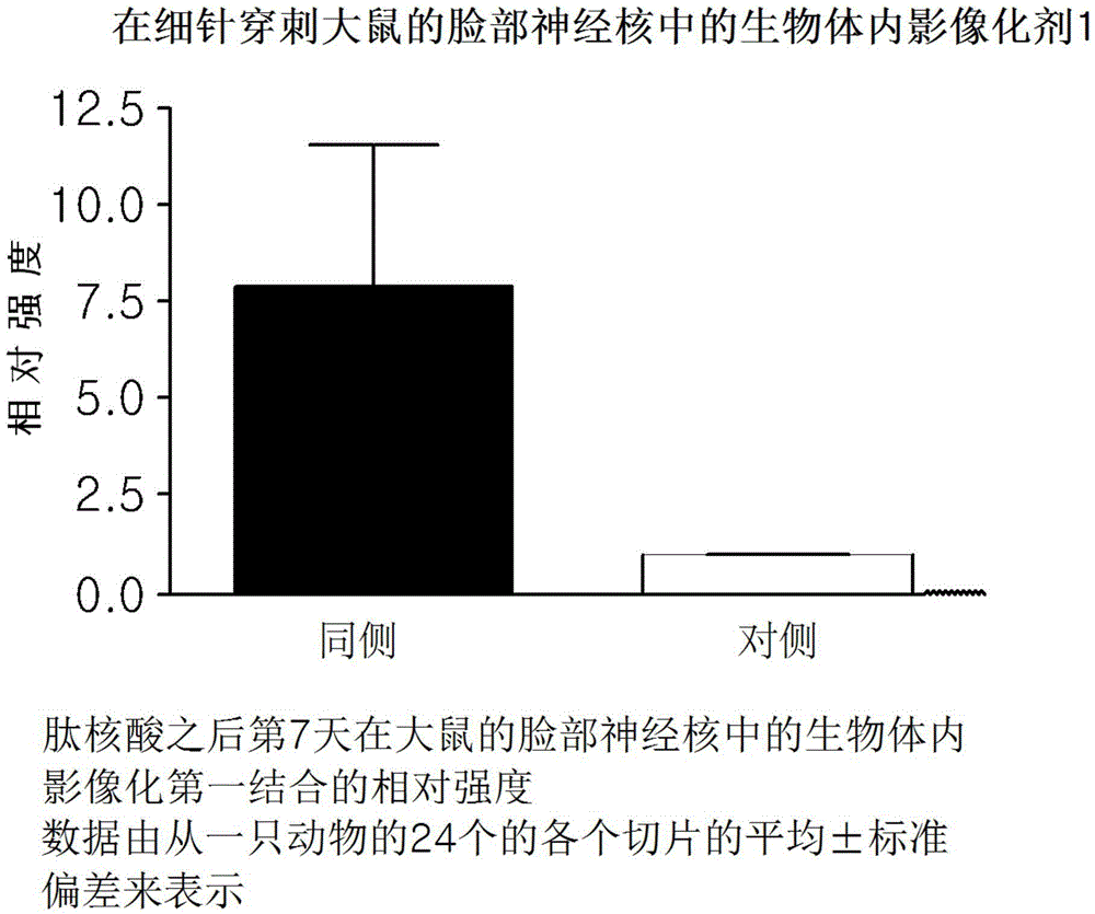 [18f]fluoromethyl group-introduced radiotracer for positron emission tomography for targeting brain neuroinflammation, synthesis thereof, and method for evaluating biological results using same