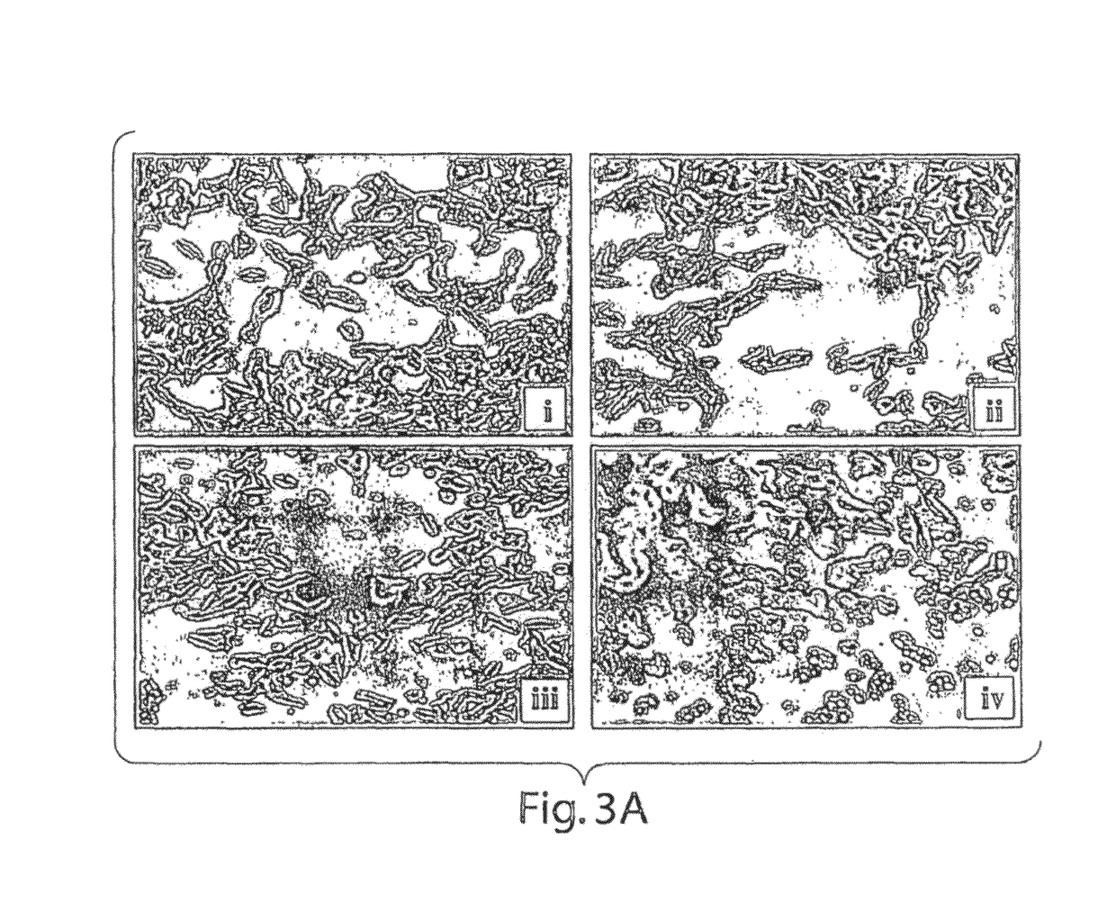 Nitrofuran compounds for the treatment of cancer and angiogenesis