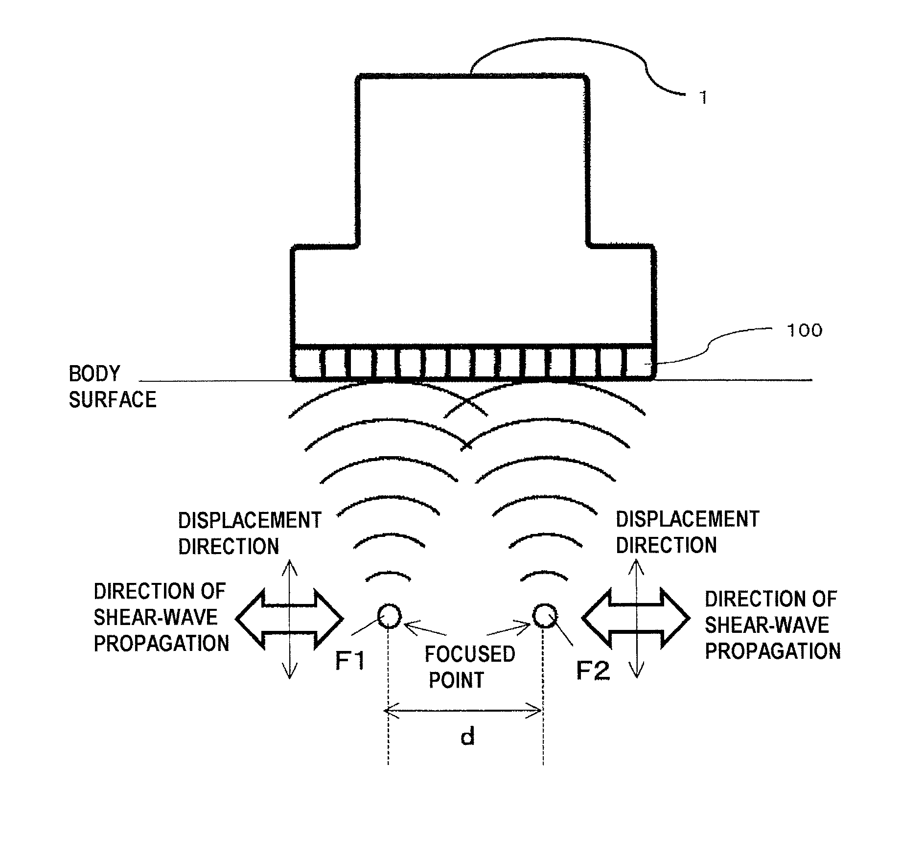 Ultrasonic diagnostic device