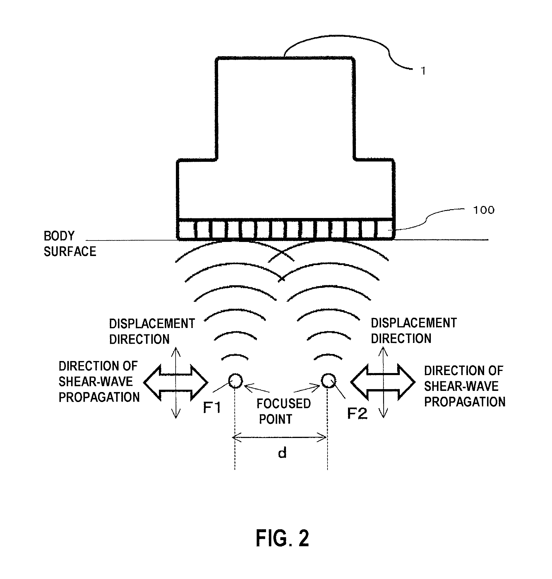 Ultrasonic diagnostic device