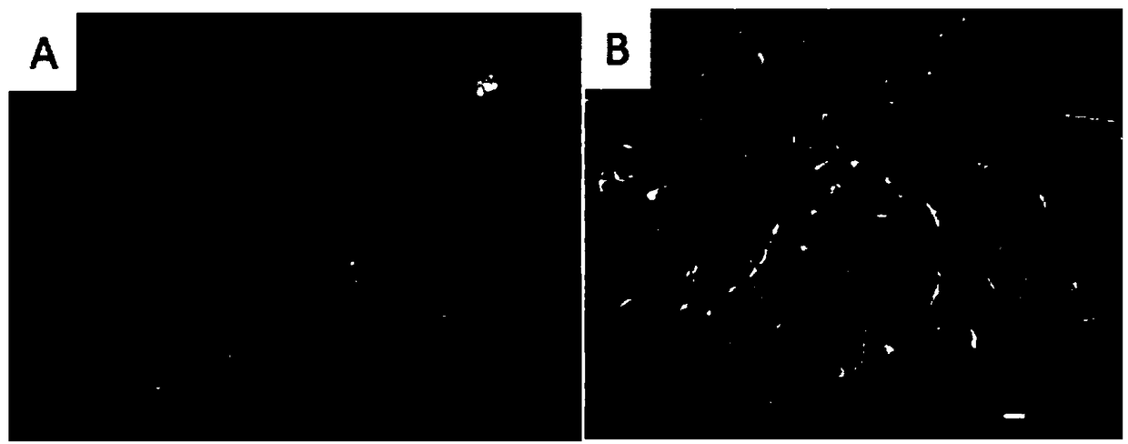 Skin injury repair material and preparation method thereof