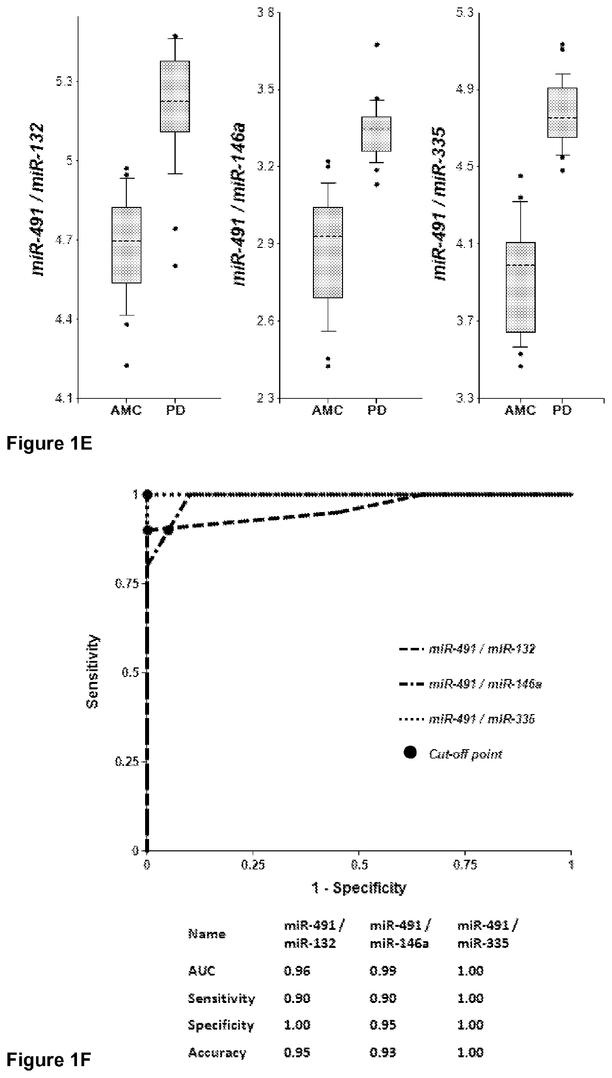 Methods of using miRNAs from bodily fluids for detection and monitoring of Parkinson's disease (PD)