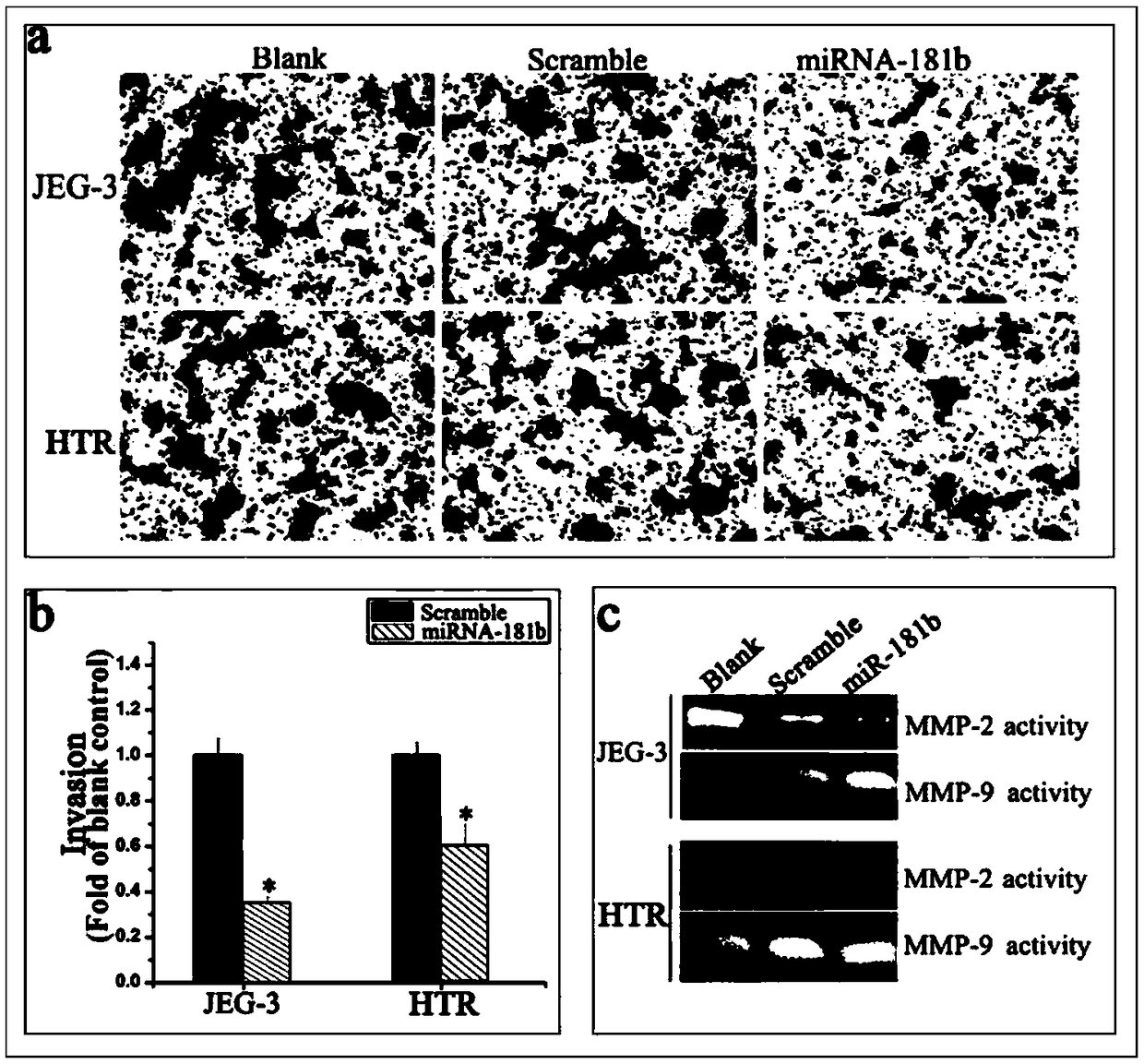 Biomarker for abnormal invasion of trophoblast cells and application thereof