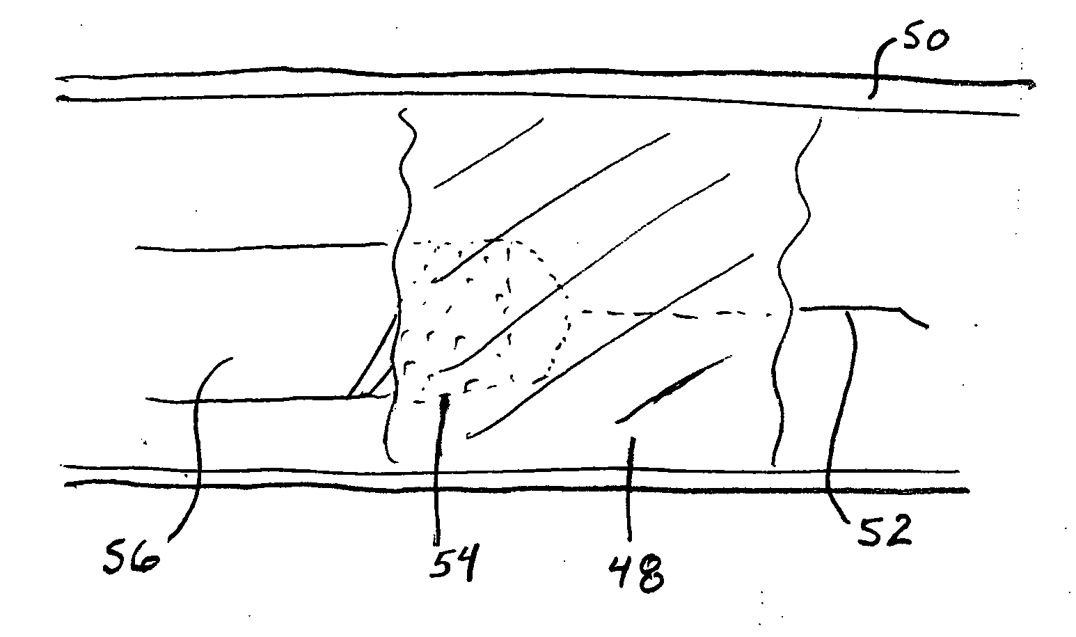 Total occlusion recanalization facilitating device