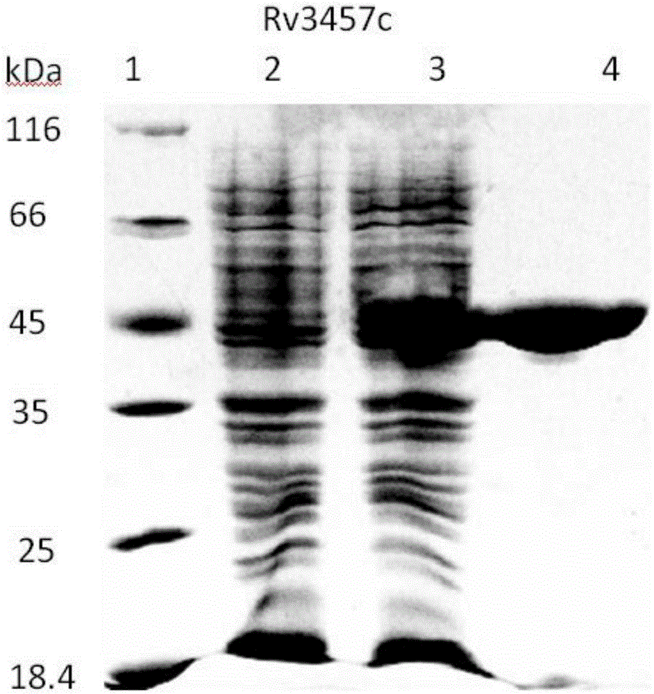 Mycobacterium tuberculosis Rv3457c recombinant protein as well as preparation method and application thereof