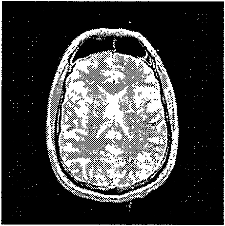 A multi-resolution medical image registration method based on quantum behaviors particle swarm algorithm