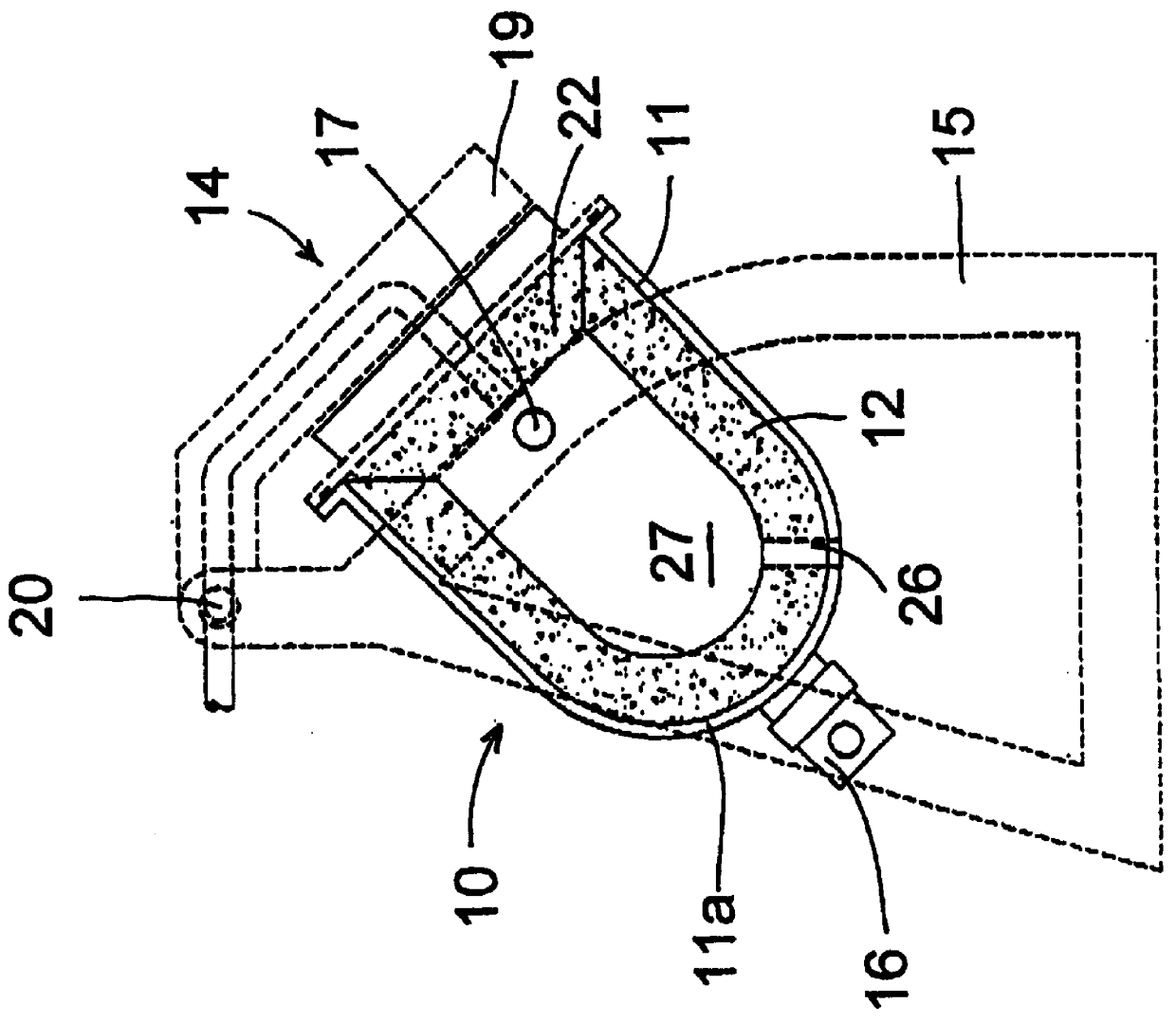 Recovery of metal from dross and apparatus therefore