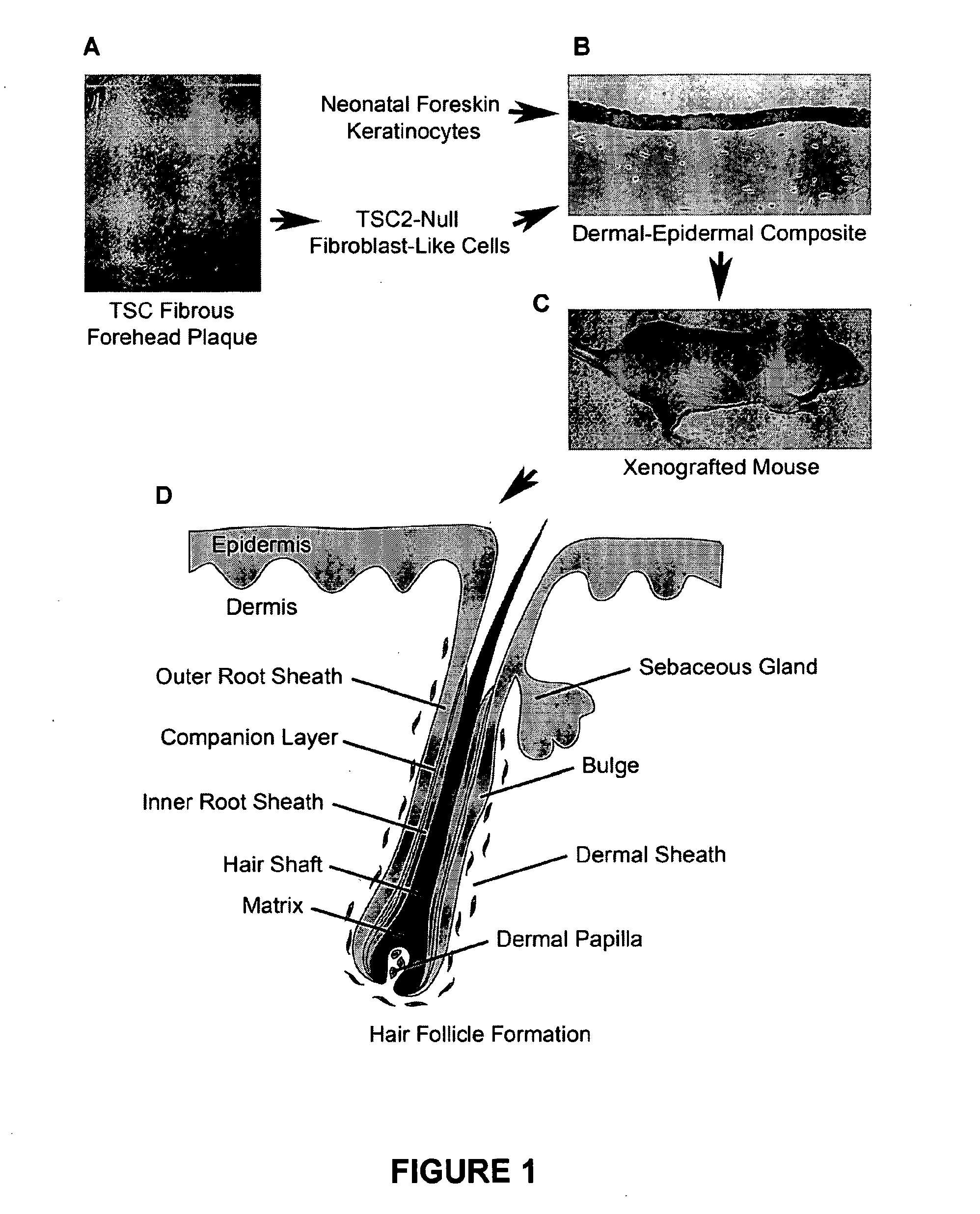 Hair follicle neogenesis