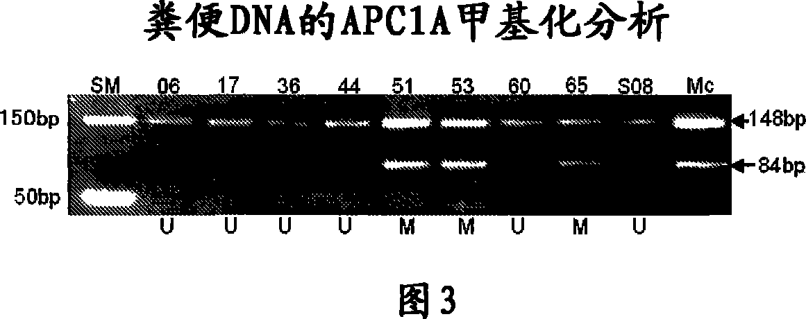 Method of detecting gene methylation and method of examining neoplasm by detecting methylation