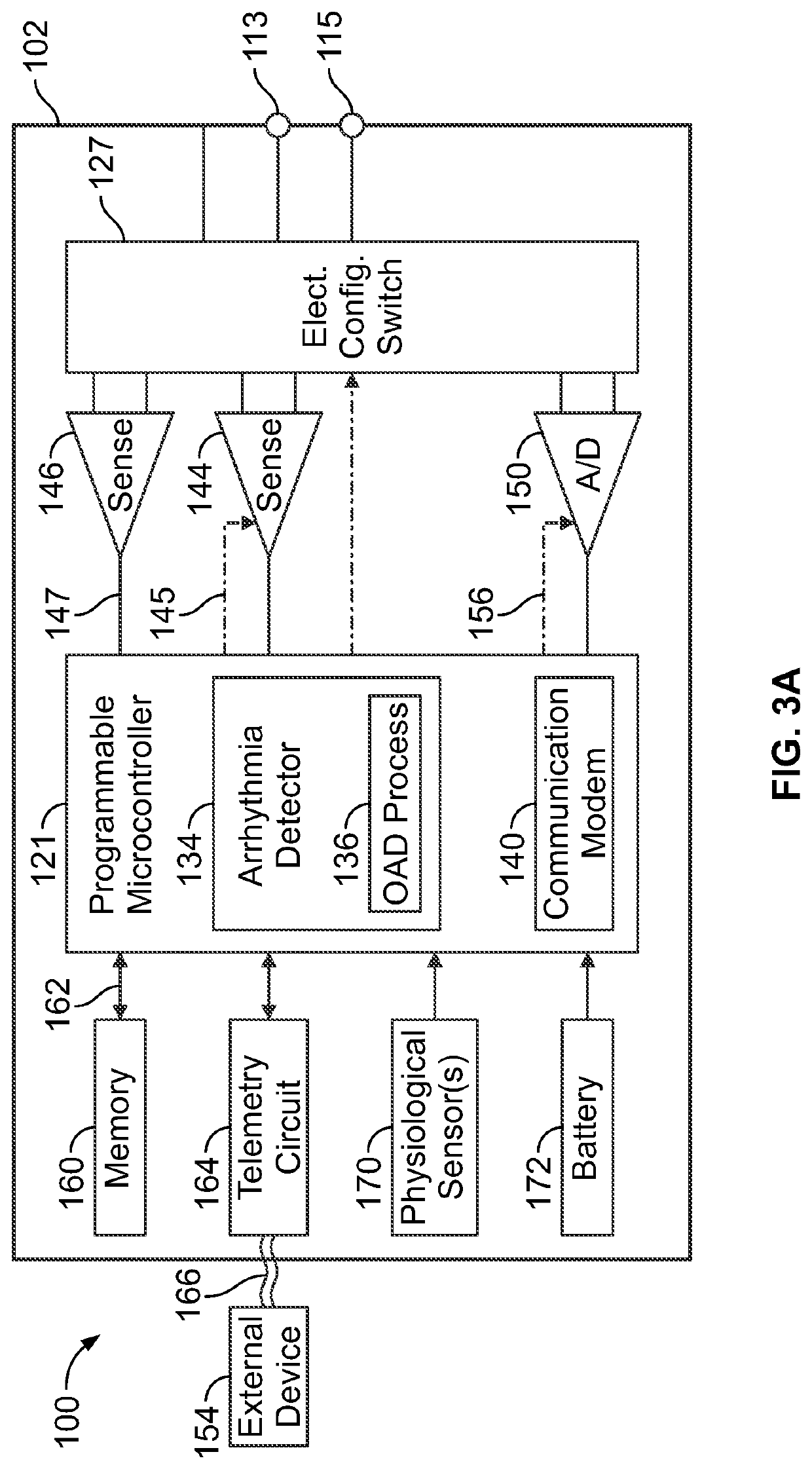 Method and system for detecting arrhythmias  in cardiac activity