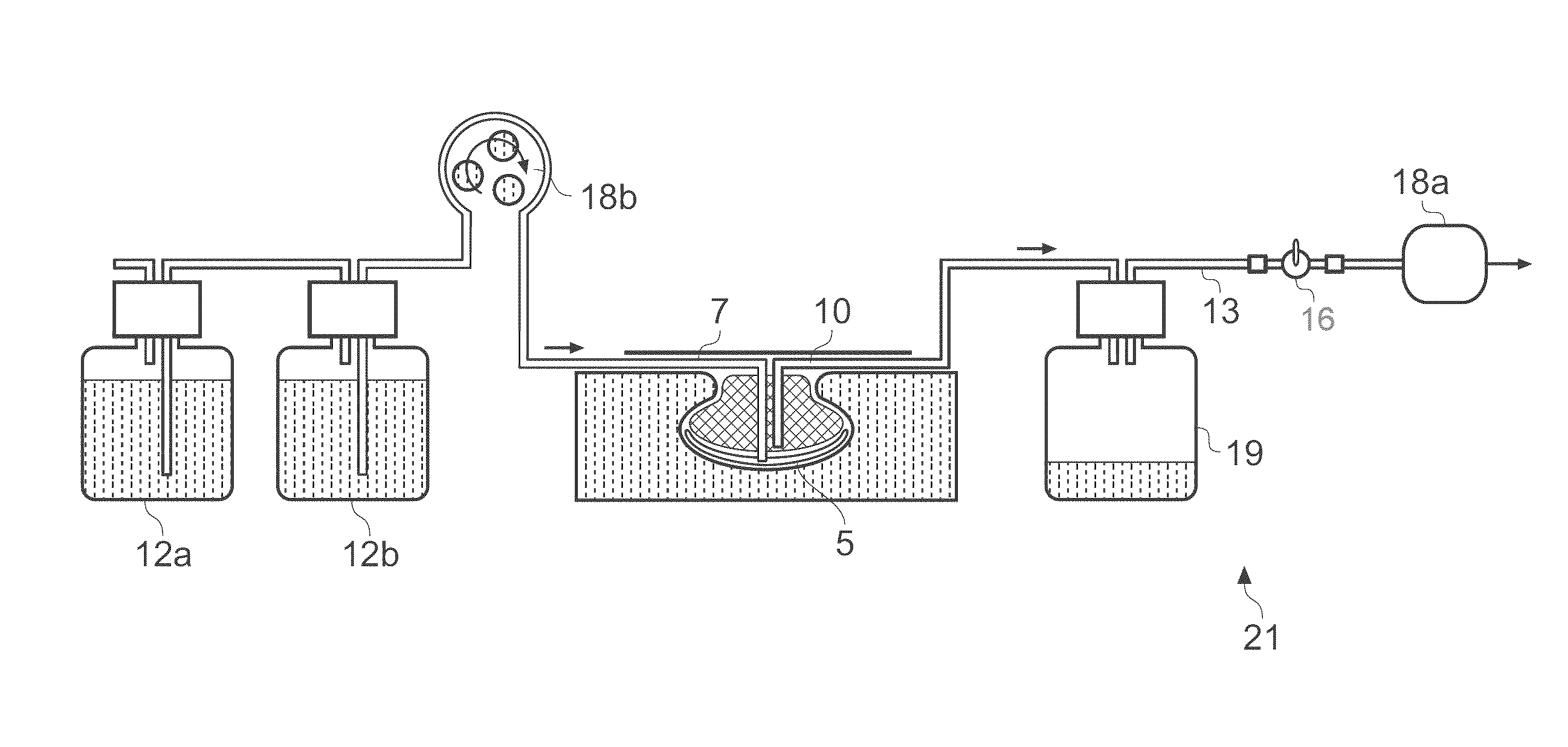 Wound treatment apparatus and method