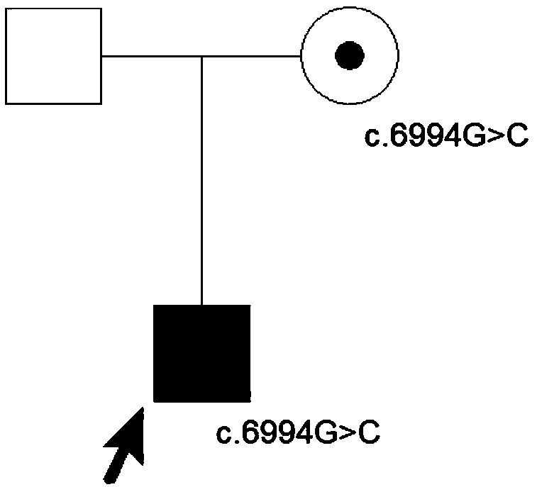 FN1 gene mutation and application thereof