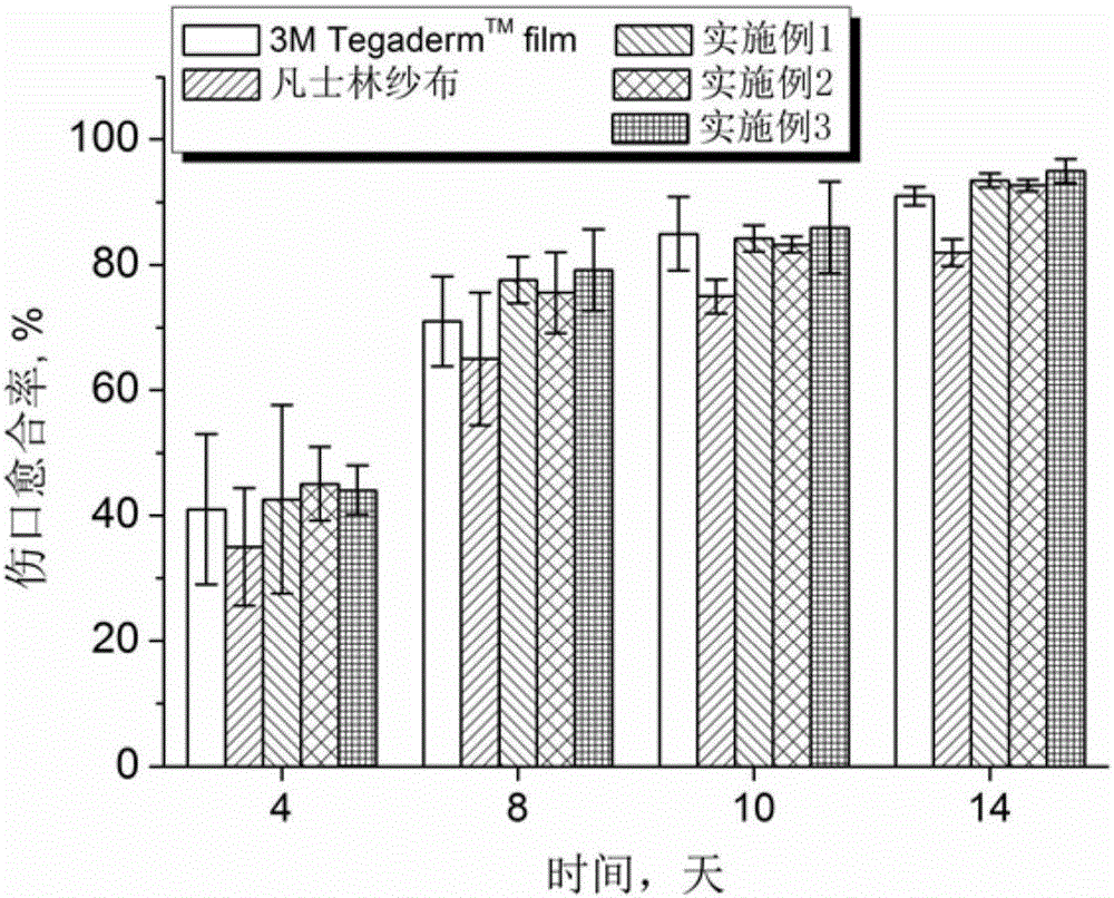 Double-layer polysiloxane super-molecular elastomer dressing for chronic skin wounds and preparation method thereof