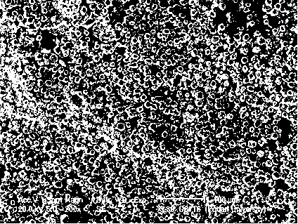 Preparation method for polyacrylonitrile immobilized enzyme