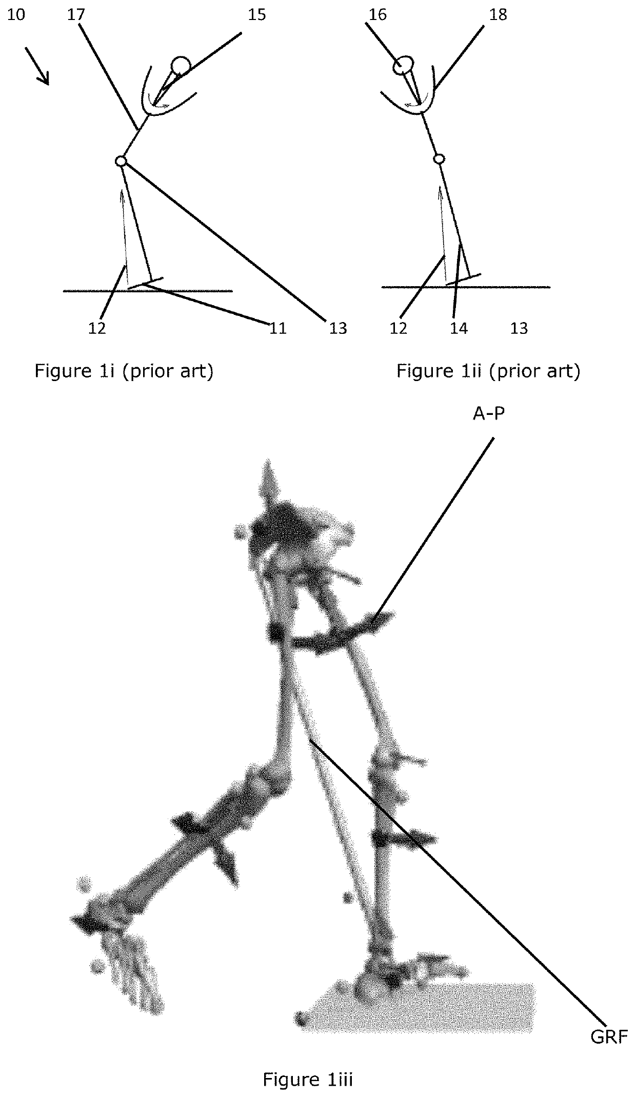 Prosthetic joints